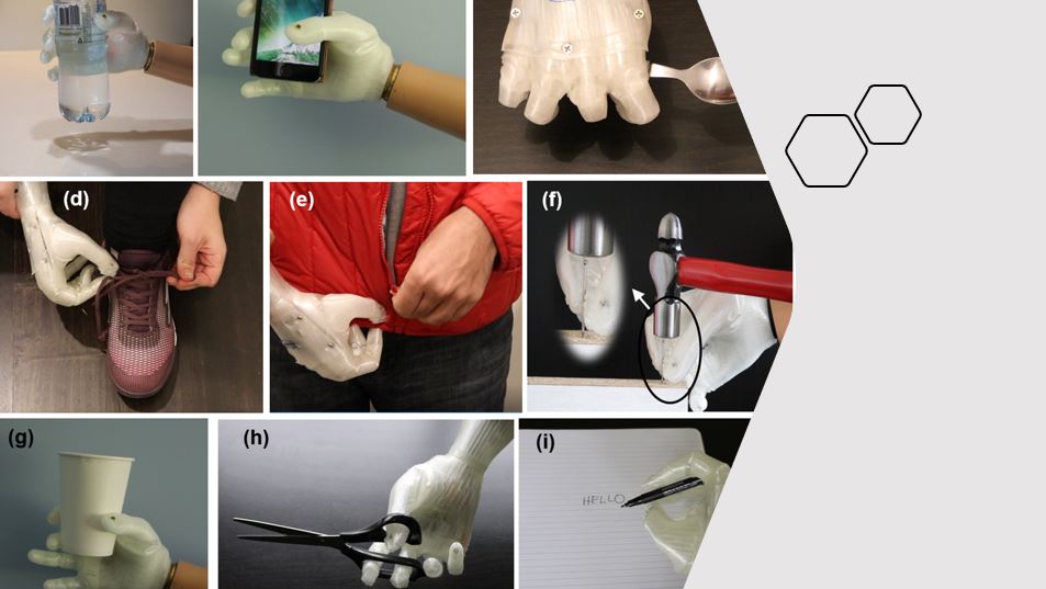 MedTech News - 3D printed limb to be the more cost-effective future of prosthetics