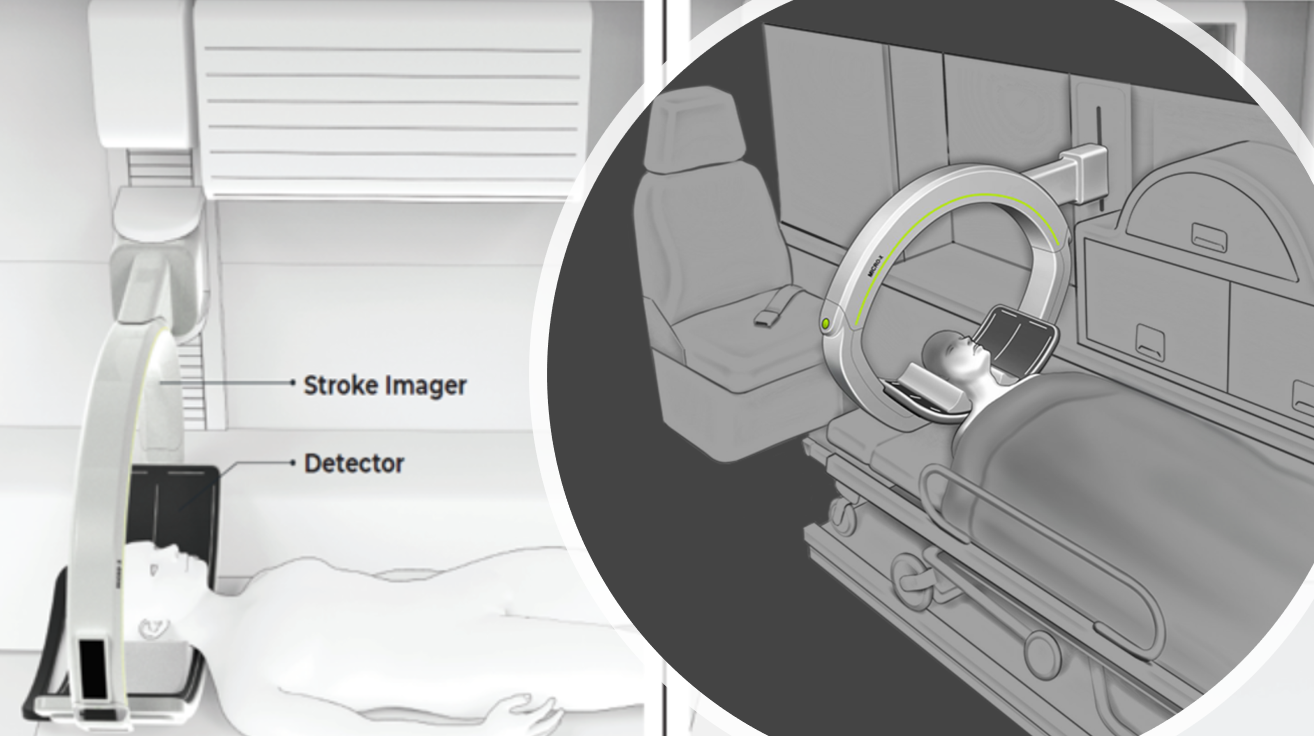 MedTech News - Novel CT scanner speeds up stroke diagnosis