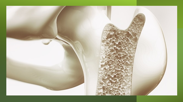 MedTech News - World-first 3D-printed implant approved