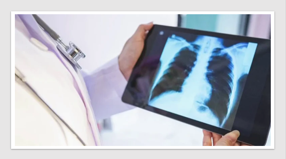 Aussie medtech partners with Philips to expand access to lung screening